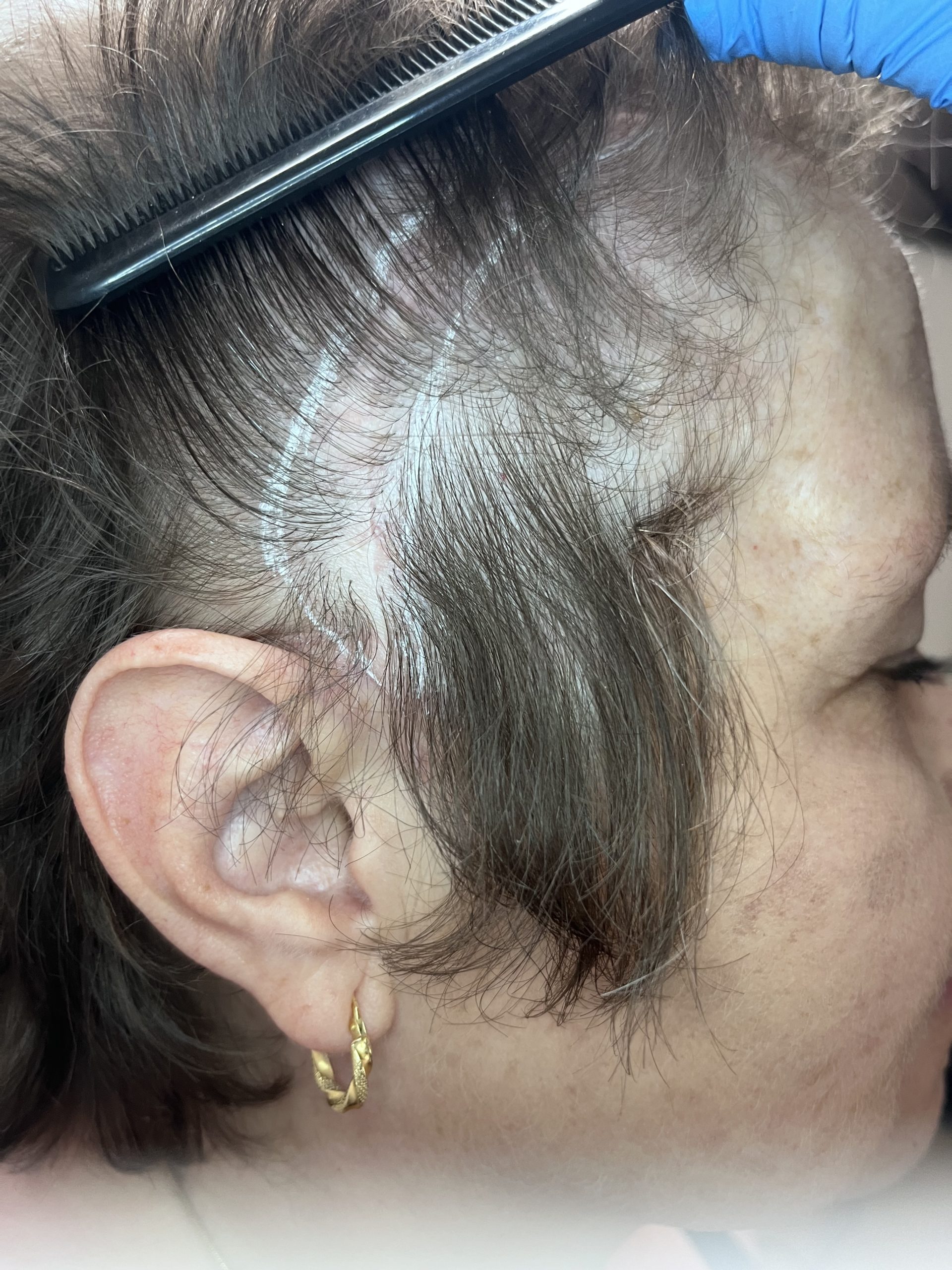 Testimonio de clientes satisfechos con micropigmentación capilar en The LeveL Capilar